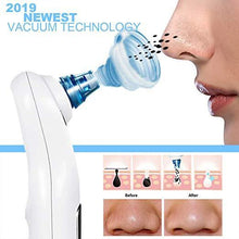 Load image into Gallery viewer, Vacuum Blackhead Extractor Electric